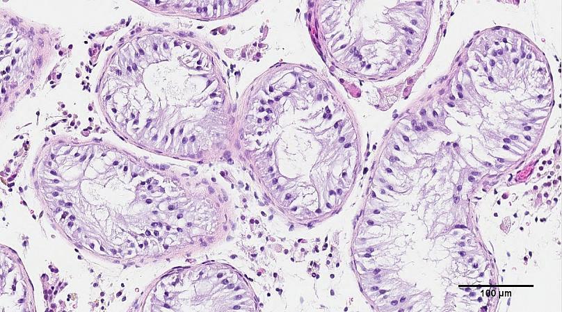 خزعة من خلايا الخصية من مريض استخدمت خلاياه للطباعةكلية الطب في الجامعة البريطانية